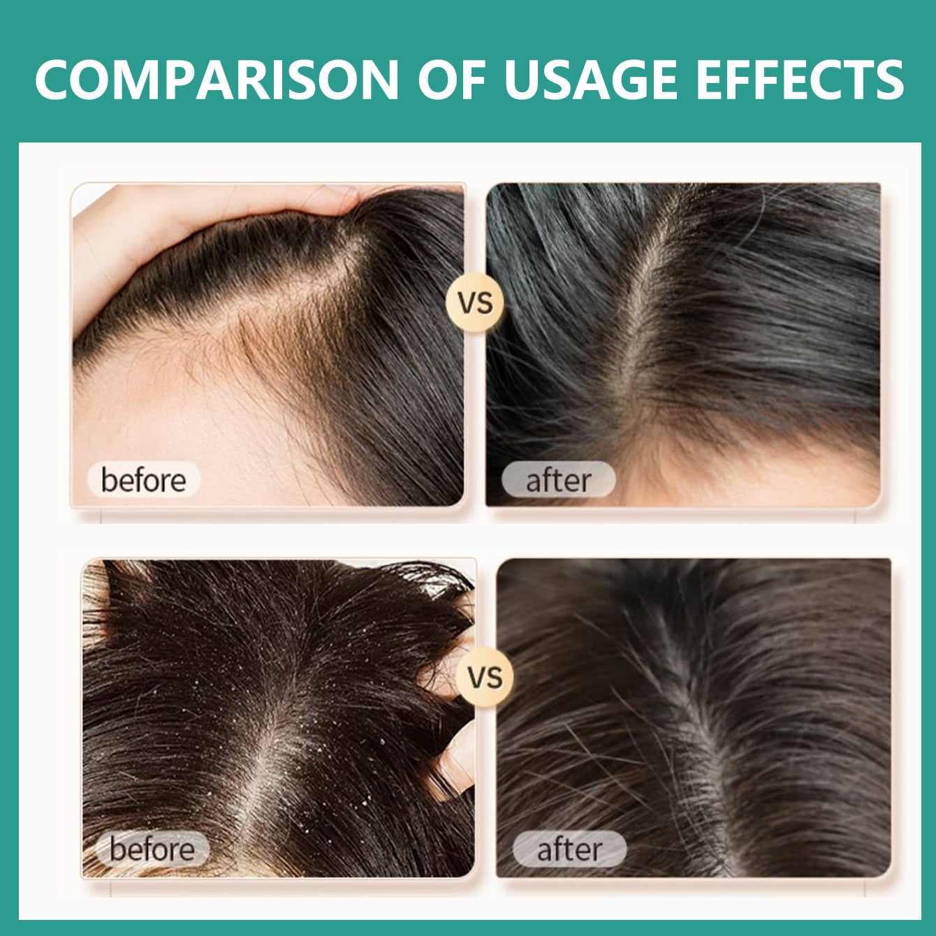 Rosemary Black Rice Water Hair Growth System Kit - Shampoo, Conditioner and Leave-in Serum - Trending Wellness Store