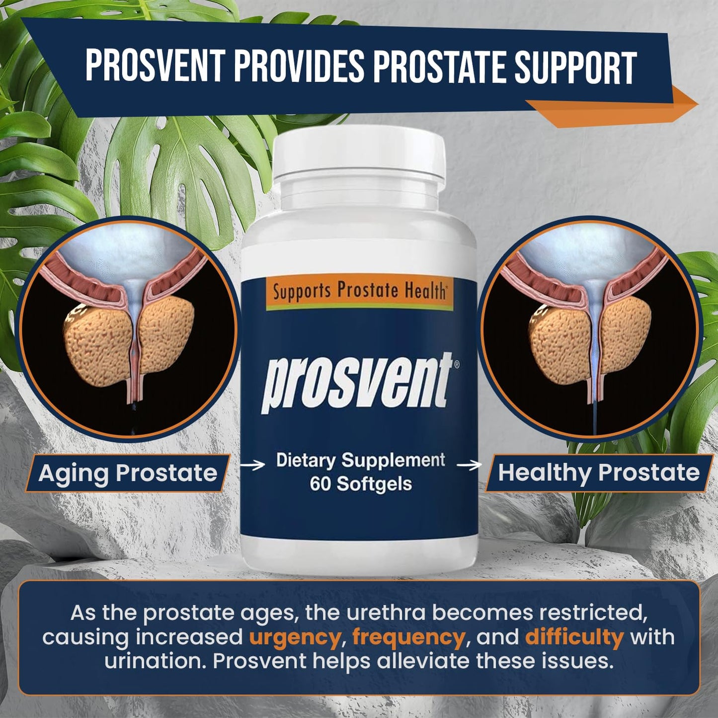 Advanced Men's Prostate Support Natural Supplement with Saw Palmetto, Vitamin D, and Zinc to Ease Urinary Frequency & Urgency (60 Count) - Trending Wellness Store