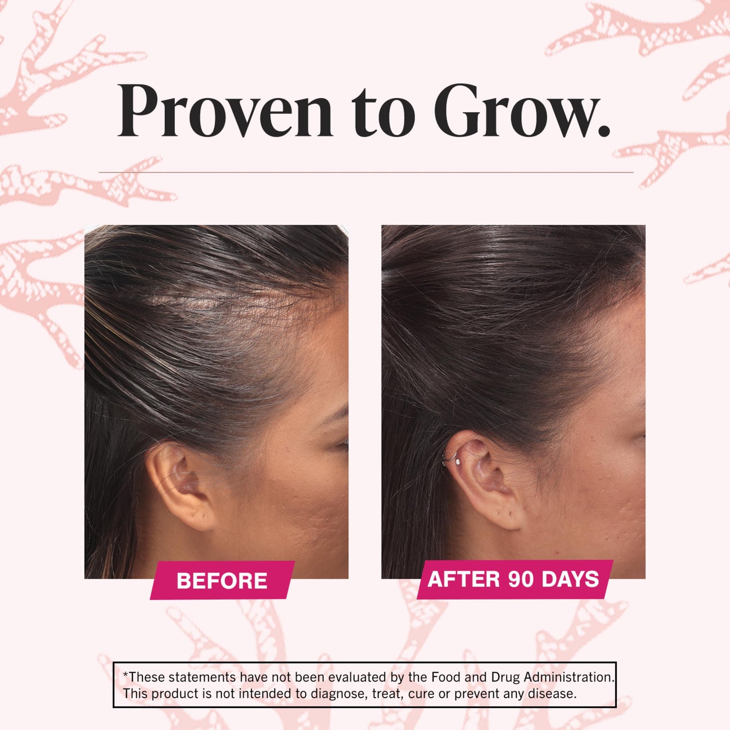 Viviscal Hair Growth Dietary Supplement - Trending Wellness Store