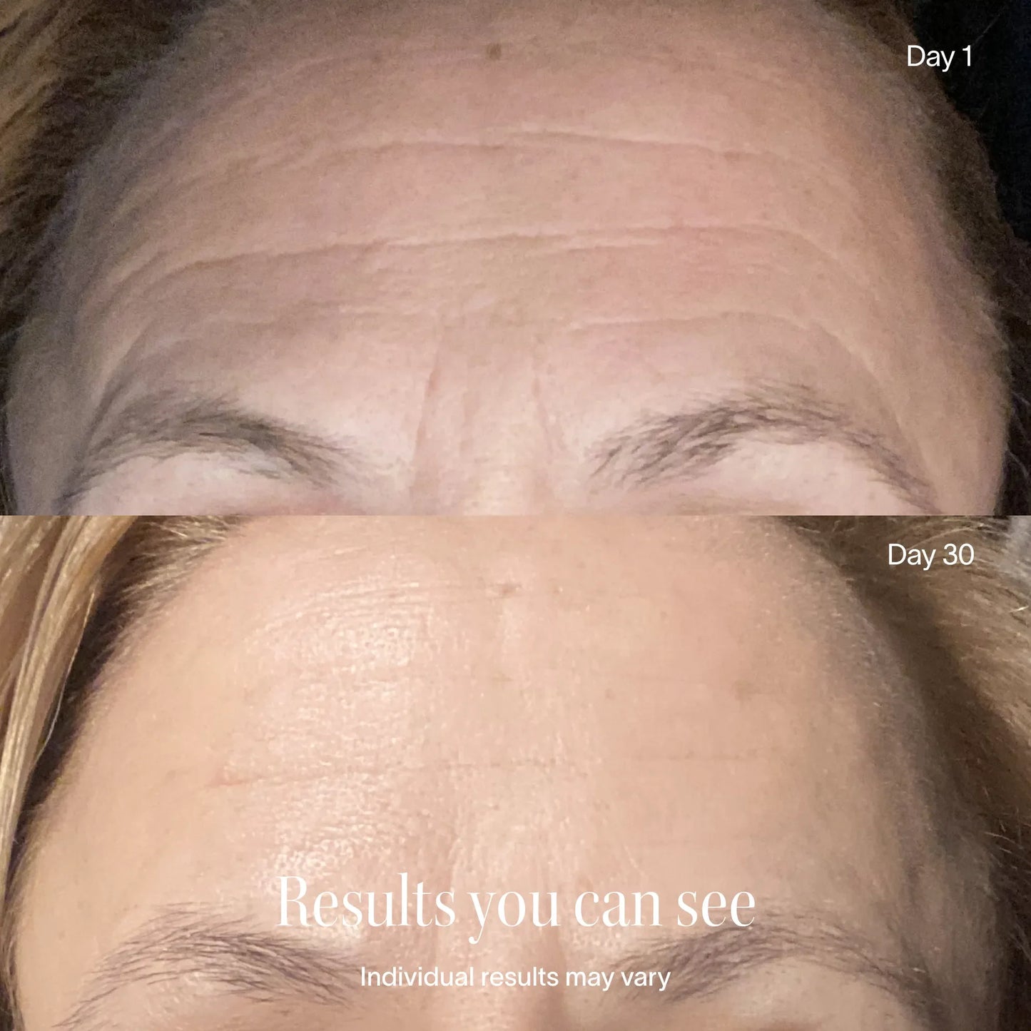 Wrinkle Retreat Face Mask & LightBoost Serum Kit - Trending Wellness Store