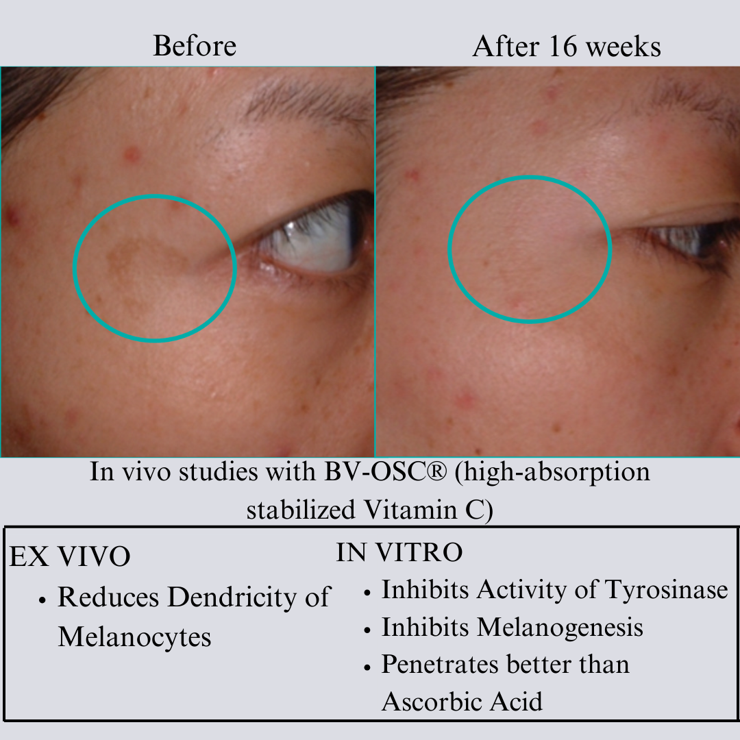 Hyaluron 3D Hydrator-Multi Lamellar Emulsion The Advanced Response Face and Neck Cream-Serum - Trending Wellness Store
