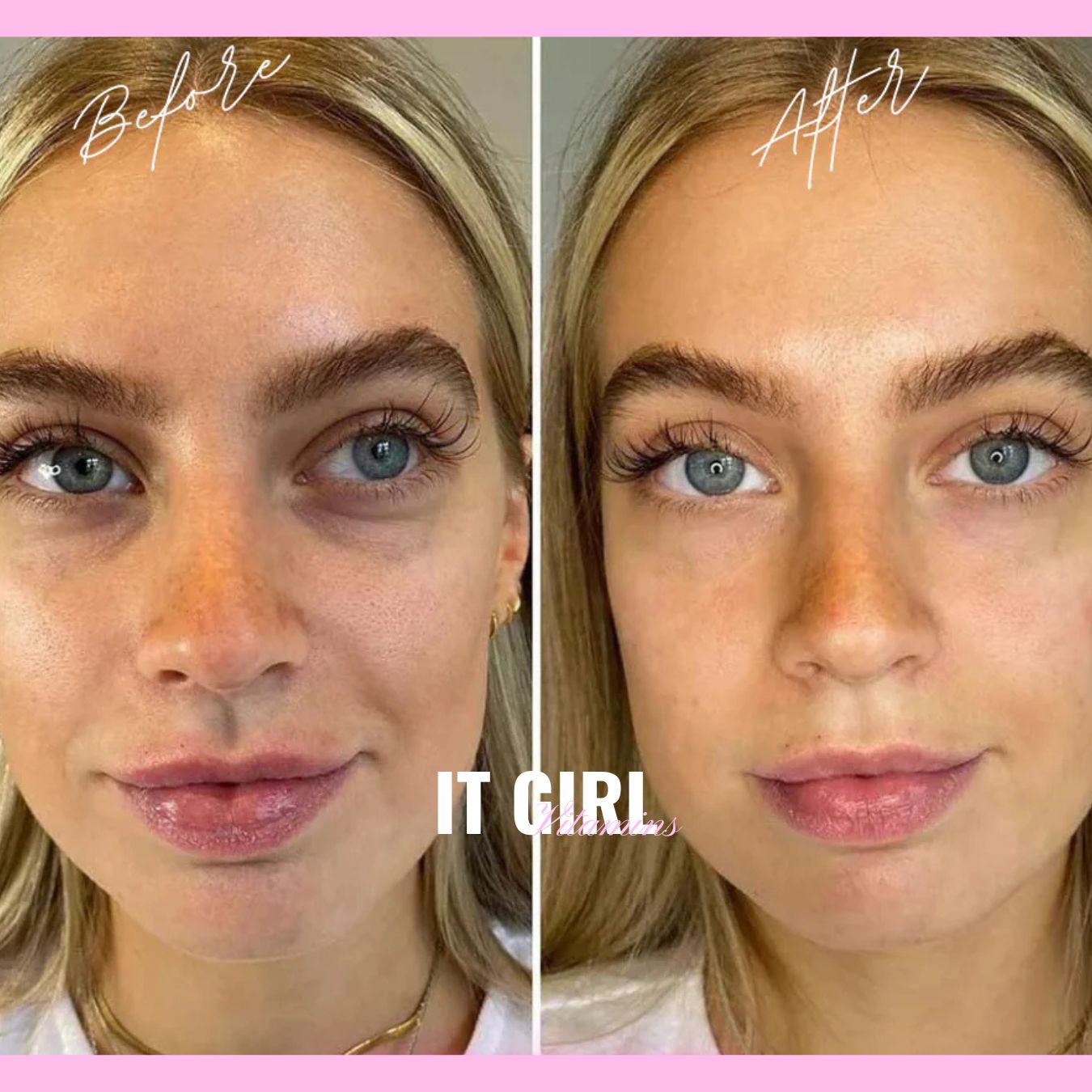 It Girl Skin – Skin Food - Trending Wellness Store