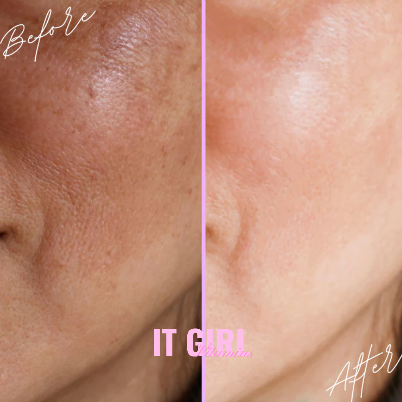It Girl Skin – Skin Food - Trending Wellness Store