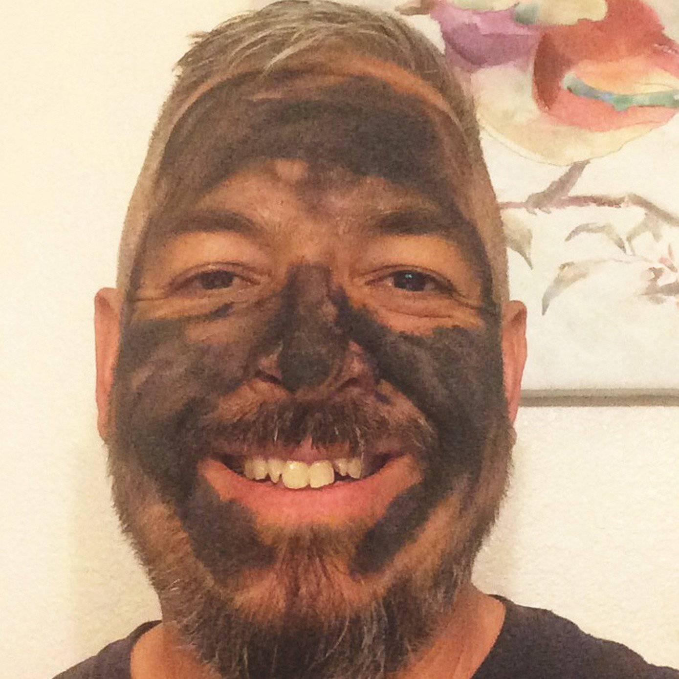 Organic Acne Face Mask - Activated Charcoal - Superior Detox & Purification - Trending Wellness Store