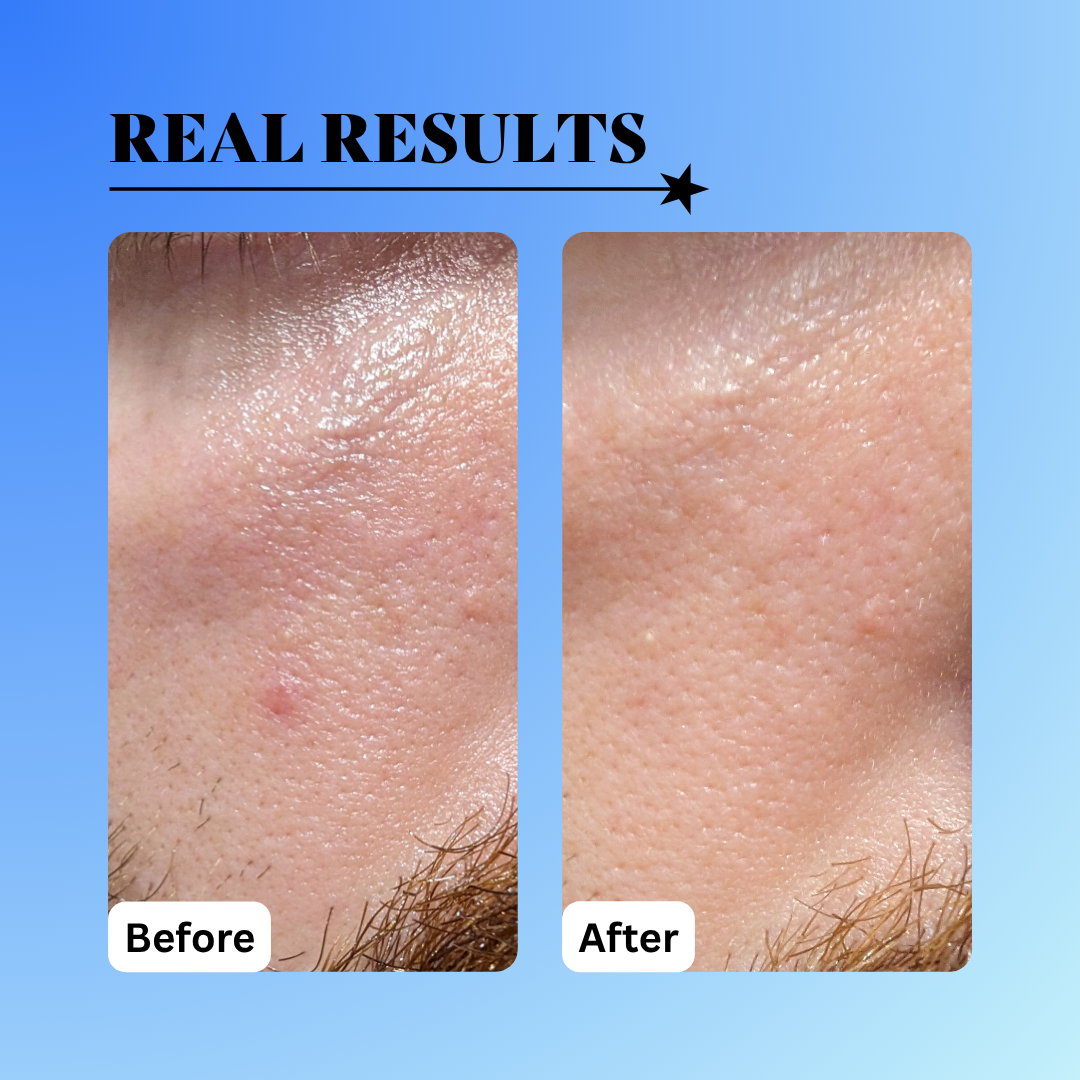 10% Glycolic Exfoliating Treatment Tonic - Trending Wellness Store