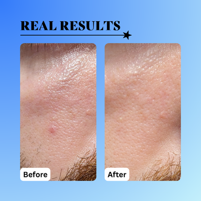 10% Glycolic Exfoliating Treatment Tonic - Trending Wellness Store