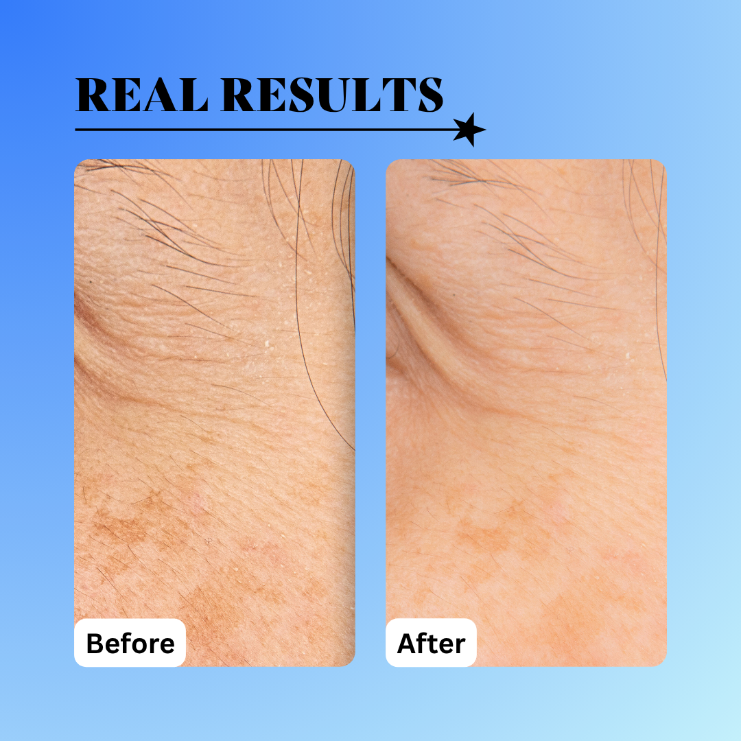 10% Glycolic Exfoliating Treatment Tonic - Trending Wellness Store