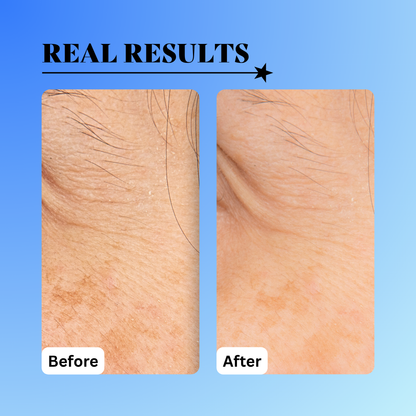 10% Glycolic Exfoliating Treatment Tonic - Trending Wellness Store