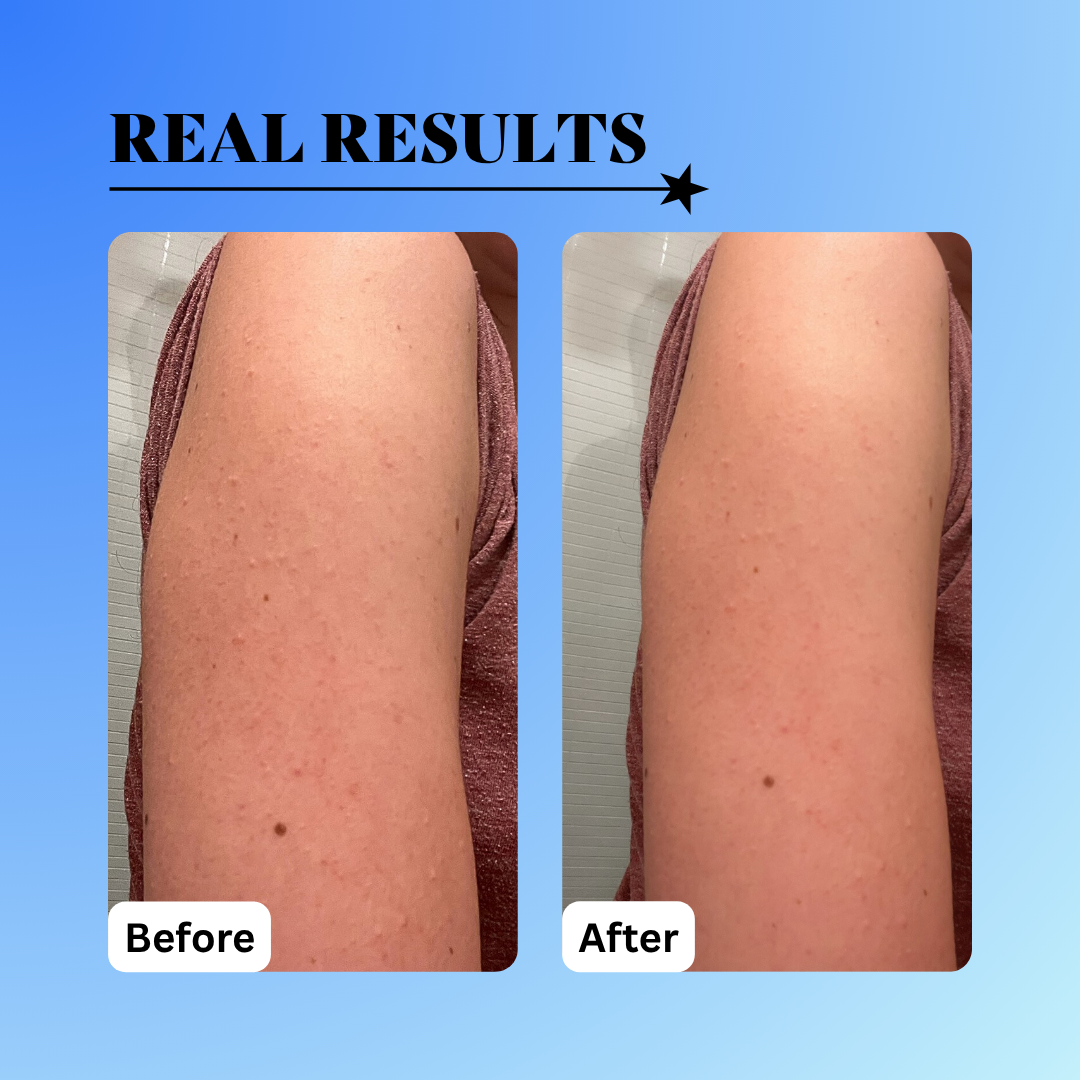 10% Glycolic Exfoliating Treatment Tonic - Trending Wellness Store