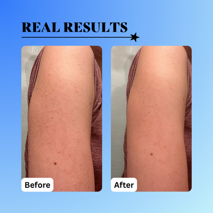 10% Glycolic Exfoliating Treatment Tonic - Trending Wellness Store