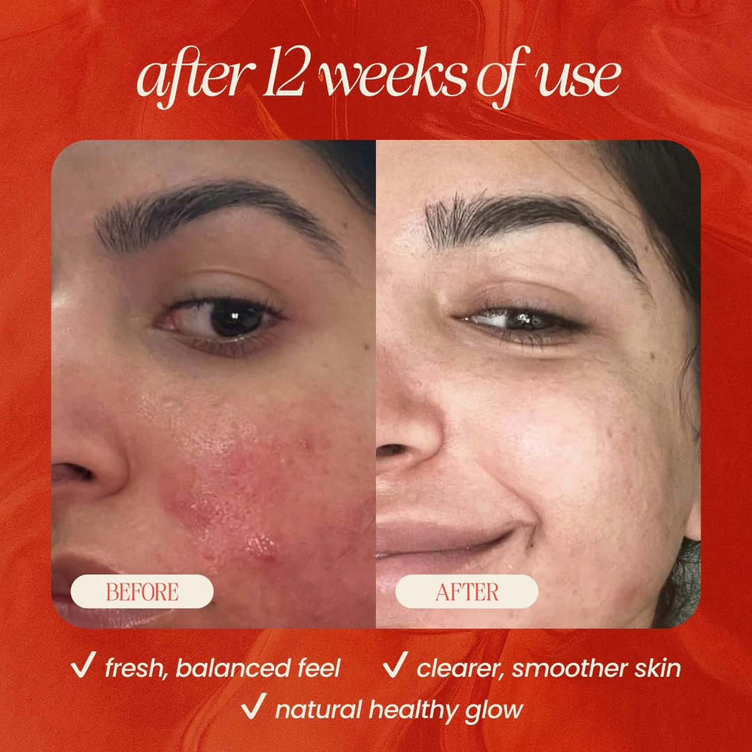 Peach & Basil Balancing Face Cleanser - Trending Wellness Store