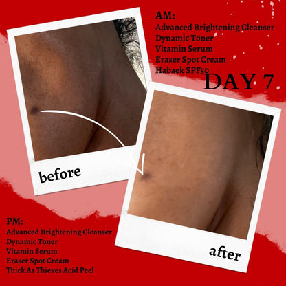 Thick As Thieves Pure Glycolic Acid Lactic Acid Extreme Gel Peel - 50ml - Trending Wellness Store