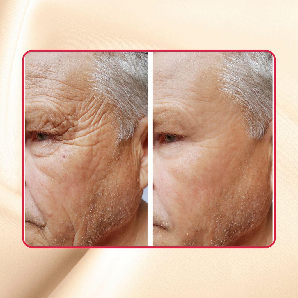 Thick As Thieves Pure Glycolic Acid Lactic Acid Extreme Gel Peel - 50ml - Trending Wellness Store