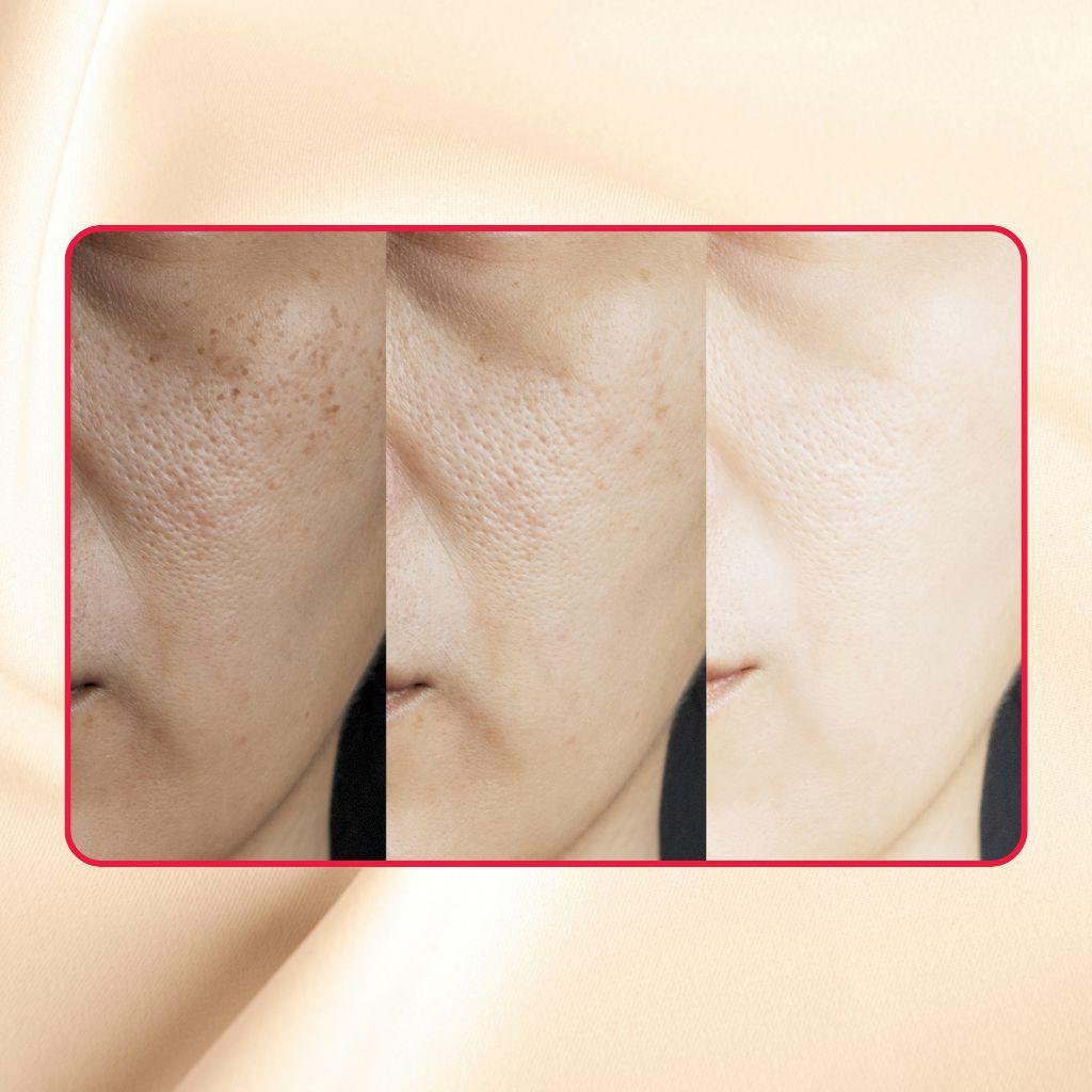 Thick As Thieves Pure Glycolic Acid Lactic Acid Extreme Gel Peel - 50ml - Trending Wellness Store