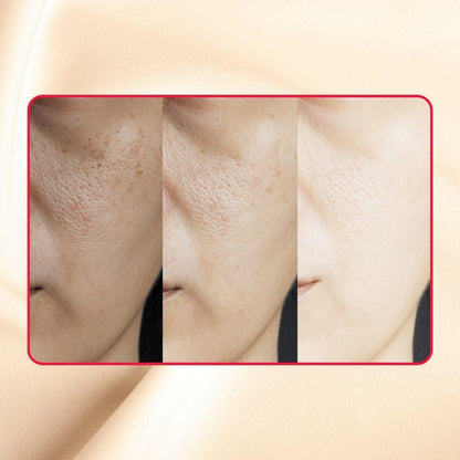 Thick As Thieves Pure Glycolic Acid Lactic Acid Extreme Gel Peel - 50ml - Trending Wellness Store