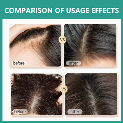 Rosemary Black Rice Water Hair Growth System Kit - Shampoo, Conditioner and Leave-in Serum - Trending Wellness Store
