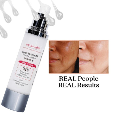 Snail Mucin 98 Power Bomb Essence - Trending Wellness Store