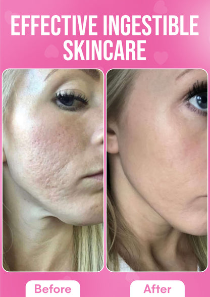 It Girl Skin – Skin Food - Trending Wellness Store