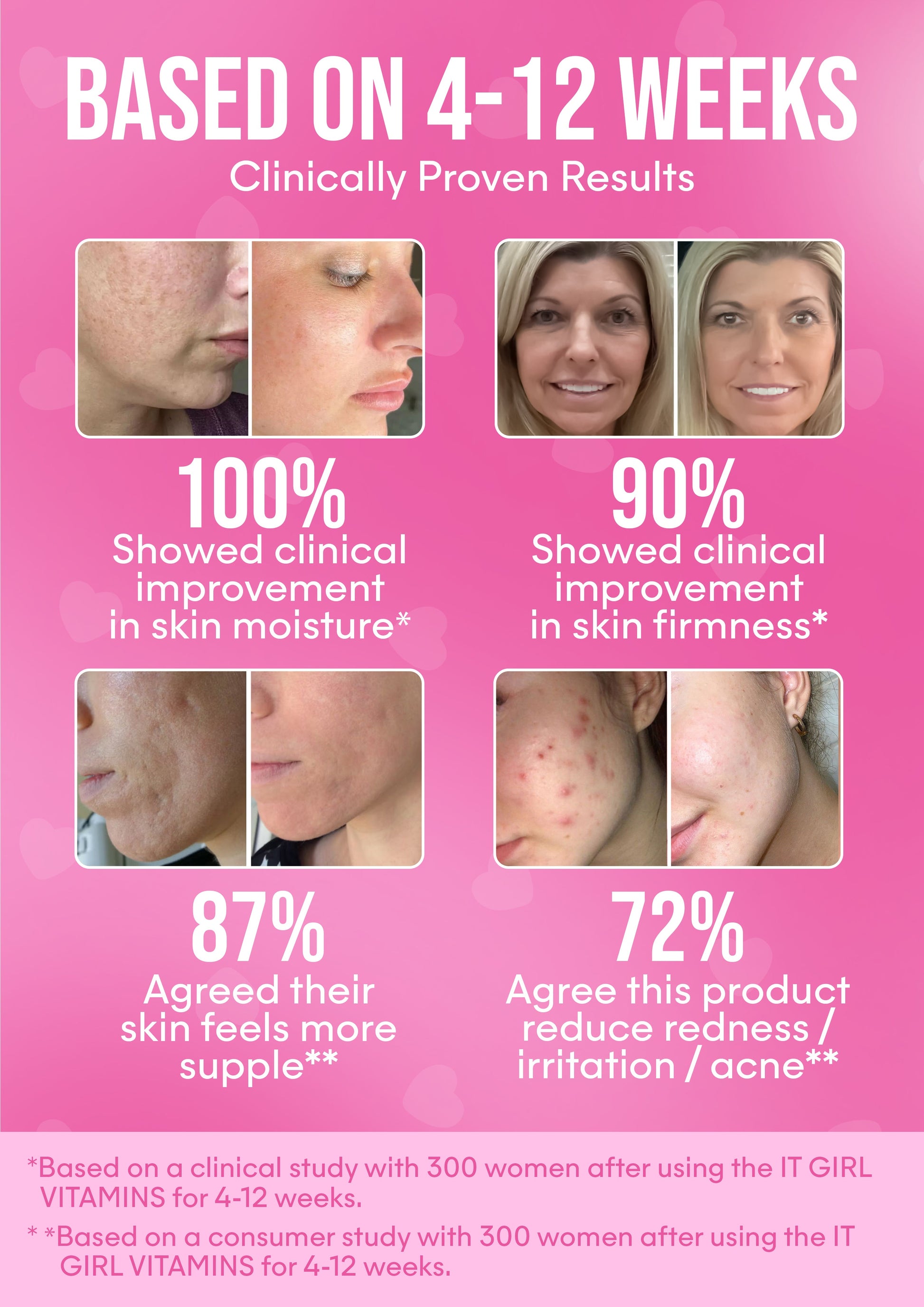 It Girl Skin – Skin Food - Trending Wellness Store