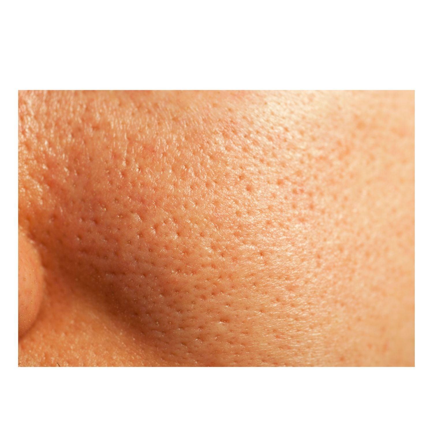 Thick As Thieves Pure Glycolic Acid Lactic Acid Extreme Gel Peel - 50ml - Trending Wellness Store