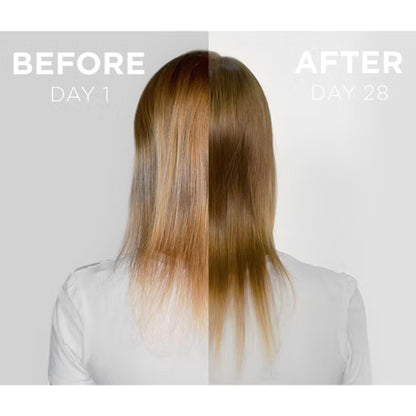 Grow Gorgeous Density Serum Intense - Hair Growth Serum With Caffeine. For Thin and Damaged Hair. Increases Thickness Of Each Strand By Up To 13%. 2 Fl Oz - Trending Wellness Store