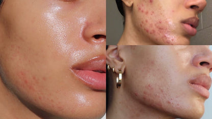 It Girl Skin – Skin Food - Trending Wellness Store