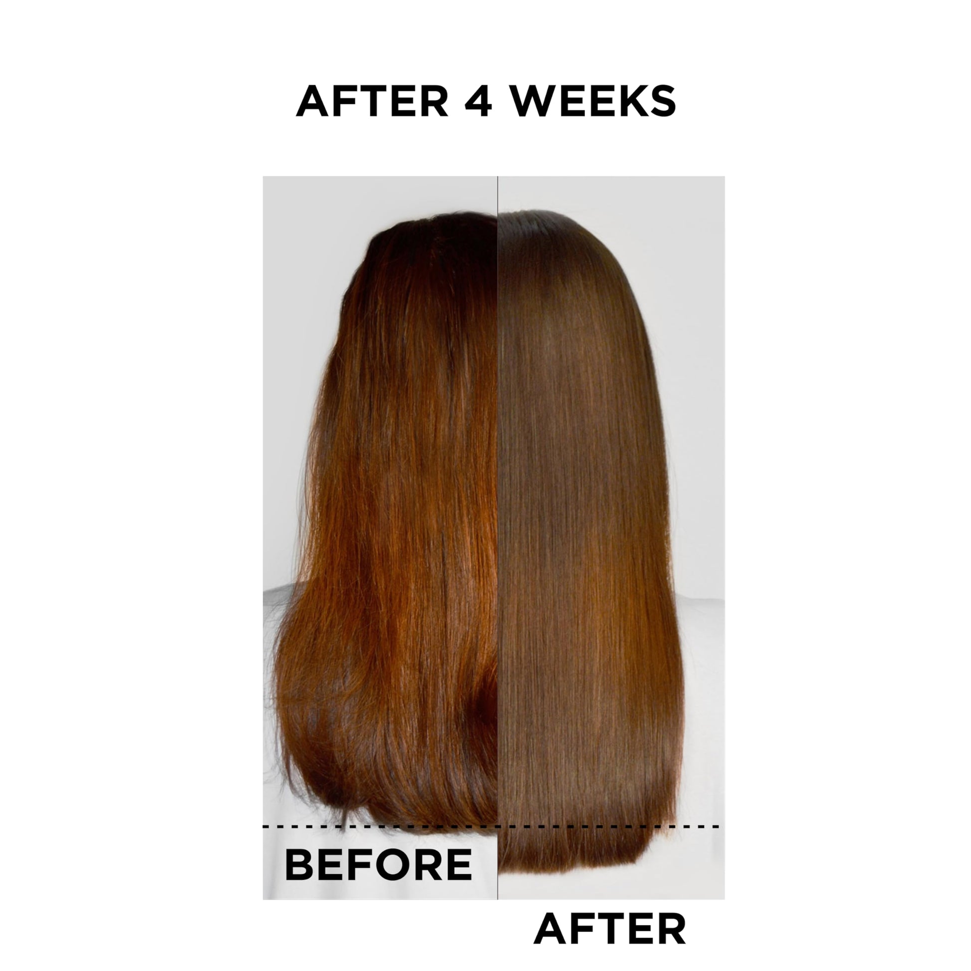 Grow Gorgeous Density Serum Intense - Hair Growth Serum With Caffeine. For Thin and Damaged Hair. Increases Thickness Of Each Strand By Up To 13%. 2 Fl Oz - Trending Wellness Store