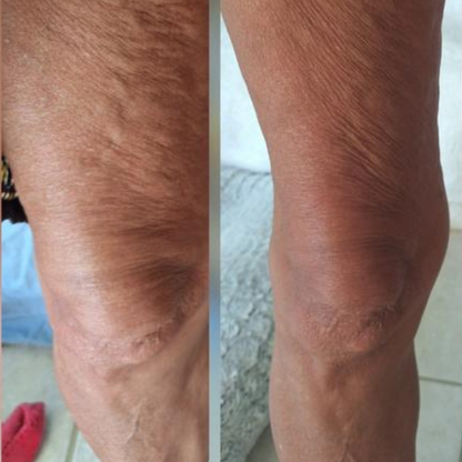 Anti-Cellulite Massage Oil - Trending Wellness Store