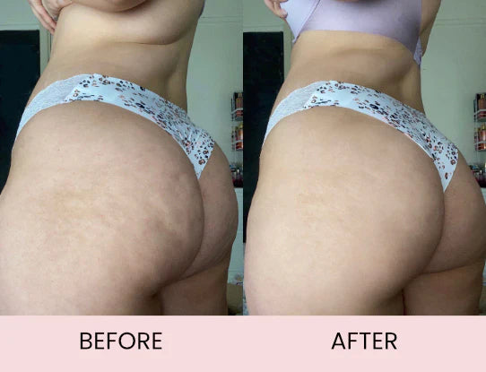 Anti-Cellulite Massage Oil - Trending Wellness Store