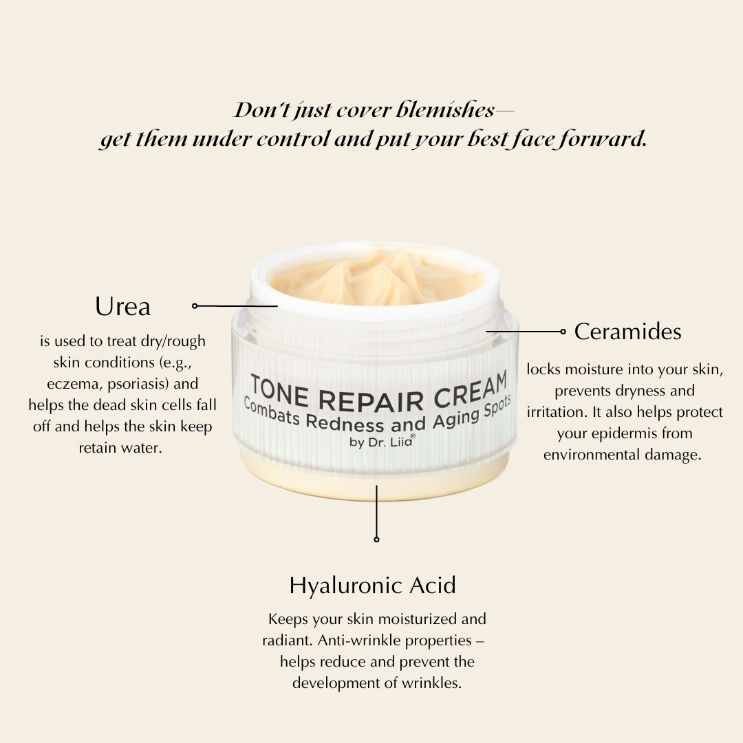 Brightening Face Cream for Redness & Hyperpigmentation - Trending Wellness Store