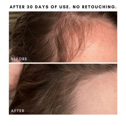 Full Of It Hair Growth Serum - Trending Wellness Store