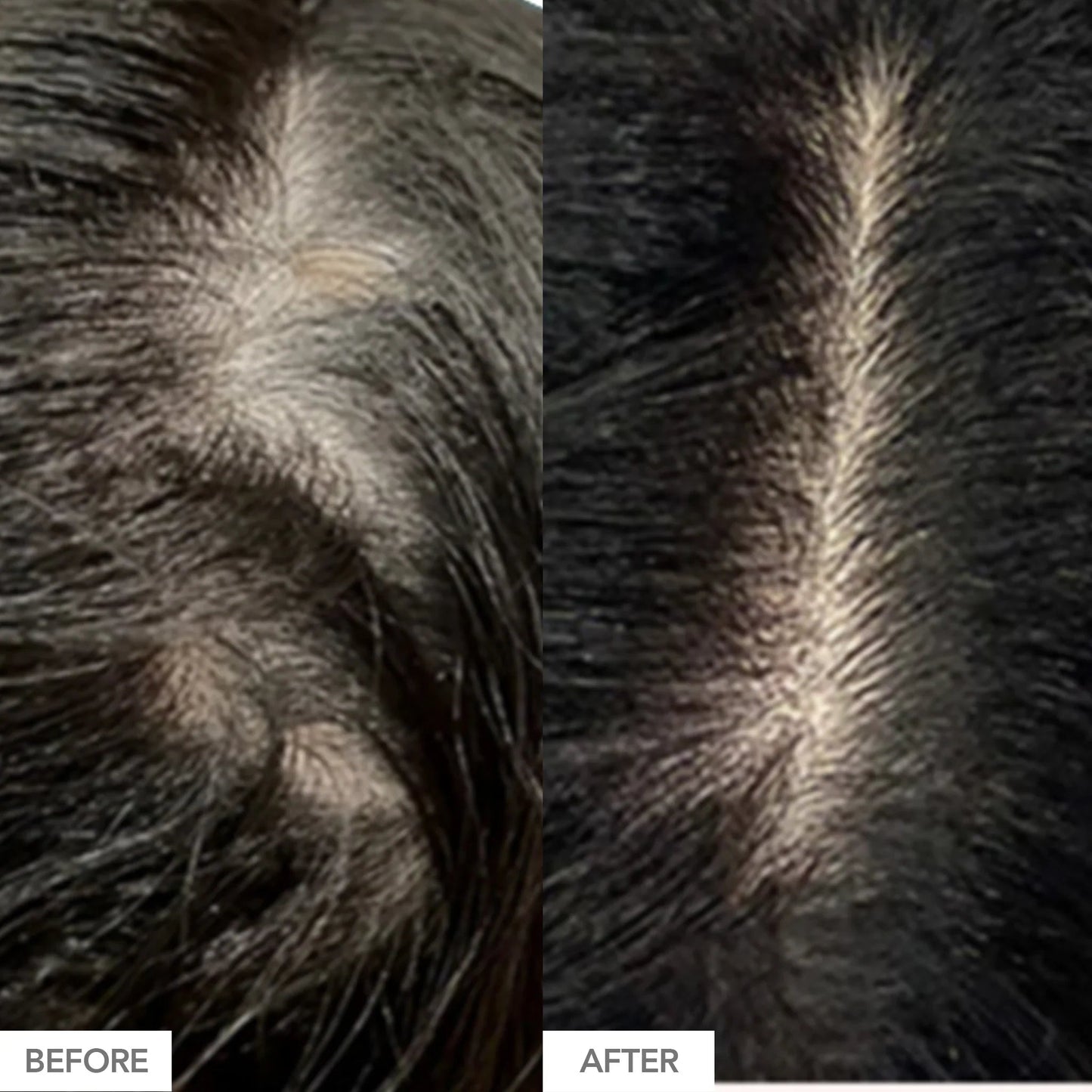 Gorgeous Growth Scalp Serum - Trending Wellness Store