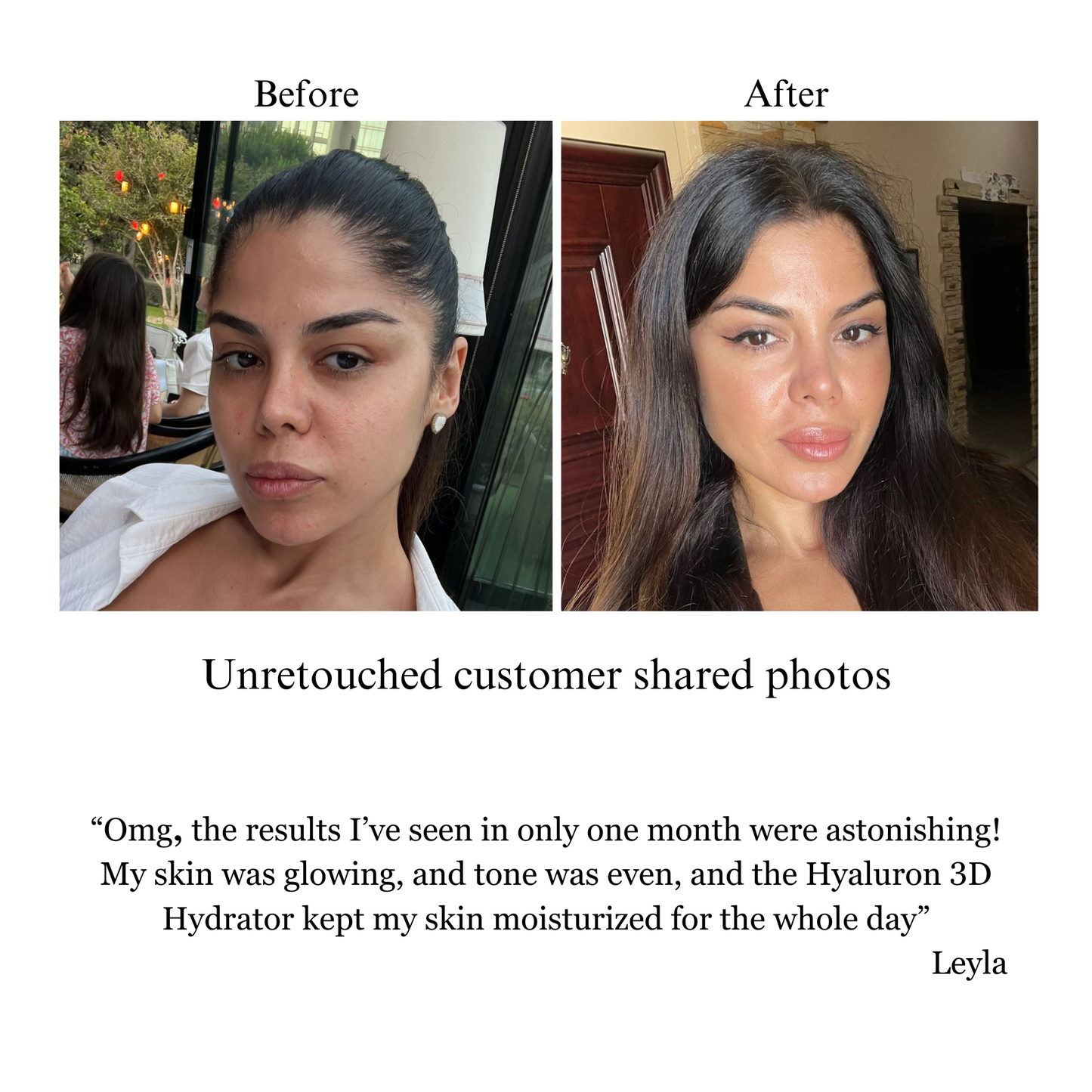 Hyaluron 3D Hydrator-Multi Lamellar Emulsion The Advanced Response Face and Neck Cream-Serum - Trending Wellness Store