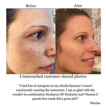 Hyaluron 3D Hydrator-Multi Lamellar Emulsion The Advanced Response Face and Neck Cream-Serum - Trending Wellness Store