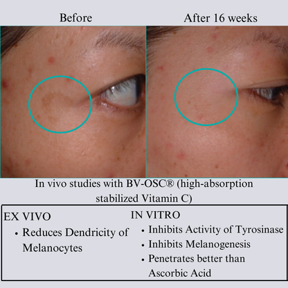 Hyaluron 3D Hydrator-Multi Lamellar Emulsion The Advanced Response Face and Neck Cream-Serum - Trending Wellness Store