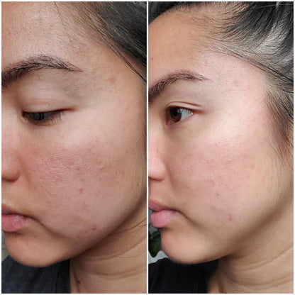 It Girl Skin – Skin Food - Trending Wellness Store