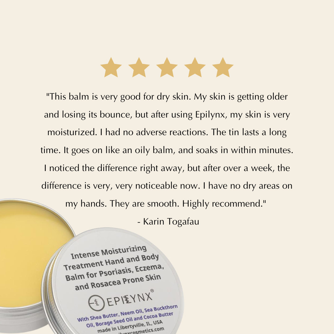 Intense Hydration Shea Butter Moisturizer for Dry Skin - Trending Wellness Store