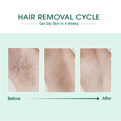 Laser IPL Hair Removal - Trending Wellness Store