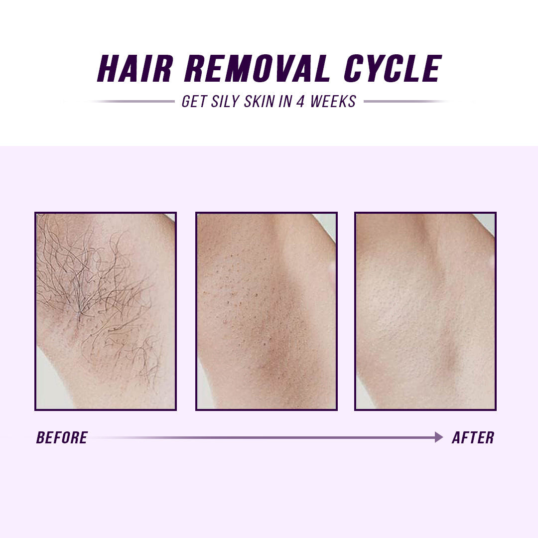 Laser IPL Hair Removal - Trending Wellness Store