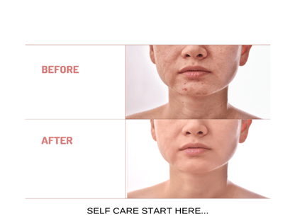 Organic Under Eye Youth Corrector and Neck Renewal Cream Duo - For Women - Trending Wellness Store