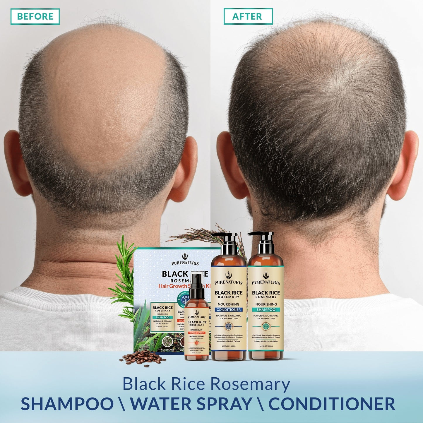 Rosemary Black Rice Water Hair Growth System Kit - Shampoo, Conditioner and Leave-in Serum - Trending Wellness Store