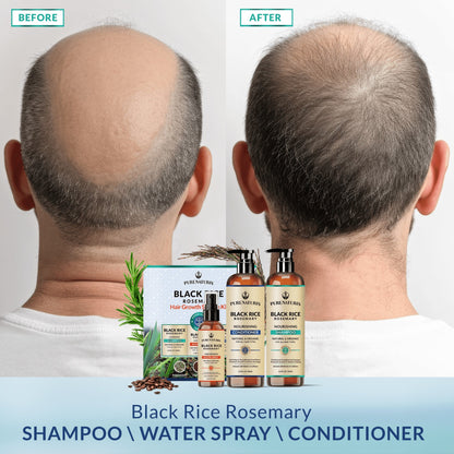 Rosemary Black Rice Water Hair Growth System Kit - Shampoo, Conditioner and Leave-in Serum - Trending Wellness Store