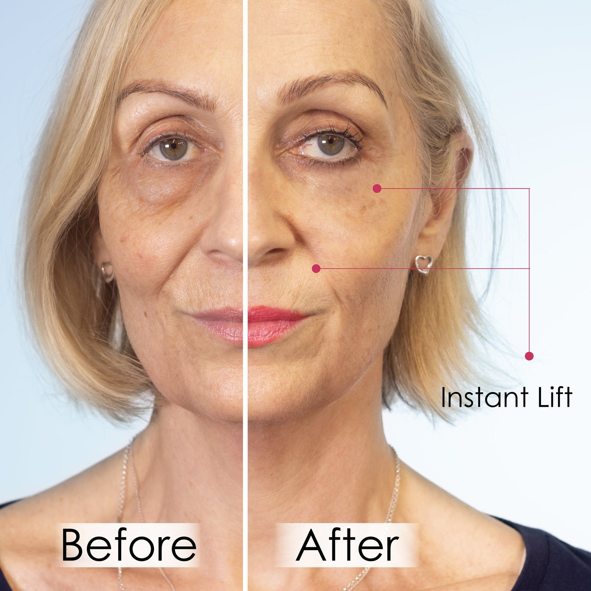 Wrinkle Killer Instant Lift with Hyaluronic Acid & Peptides - Trending Wellness Store