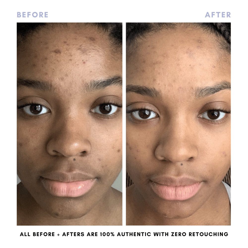 The Complete Skincare Collection - Trending Wellness Store