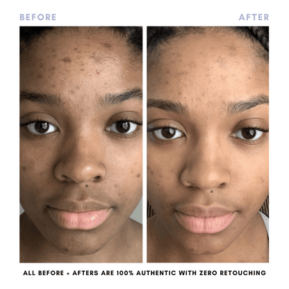 The Complete Skincare Collection - Trending Wellness Store