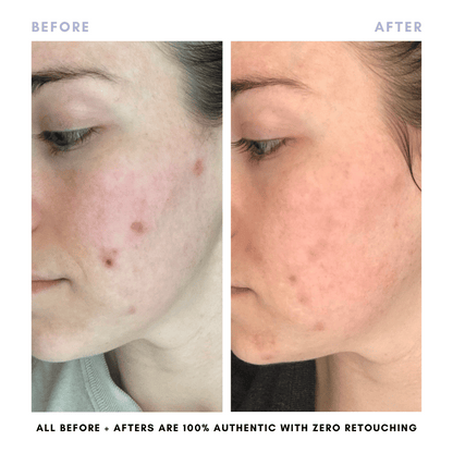 The Complete Skincare Collection - Trending Wellness Store