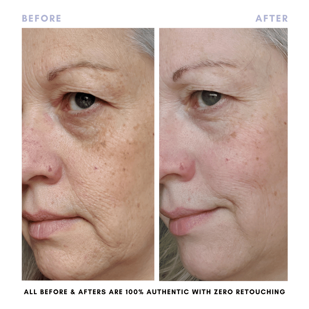 The Complete Skincare Collection - Trending Wellness Store