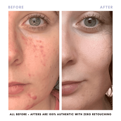 The Juicy Skin Special (+ FREE Rose Suds Cleanser) - Trending Wellness Store