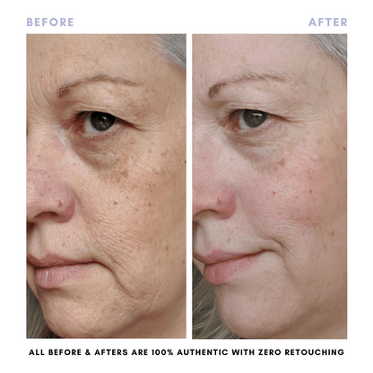 The Juicy Skin Special (+ FREE Rose Suds Cleanser) - Trending Wellness Store