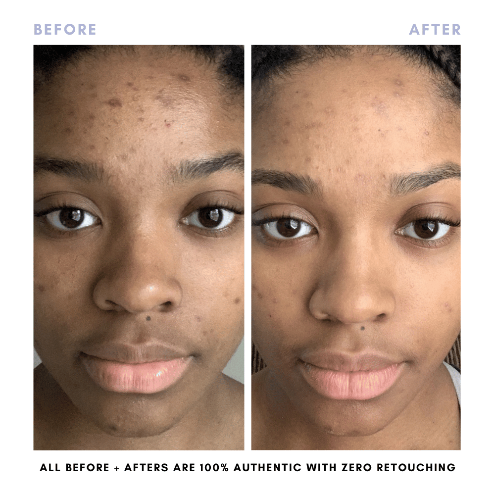 The Juicy Skin Special (+ FREE Rose Suds Cleanser) - Trending Wellness Store